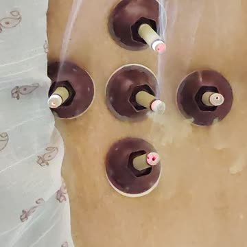 Sacrum Spine Pain Treatment with Moxa Therapy | Natural Pain Relief