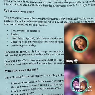 BIGOwars: Monae Shows Results of Nose Infection