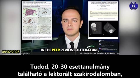 【HU】100000-rel több rákos haláleset az Egyesült Államokban a COVID vakcina bevezetése óta