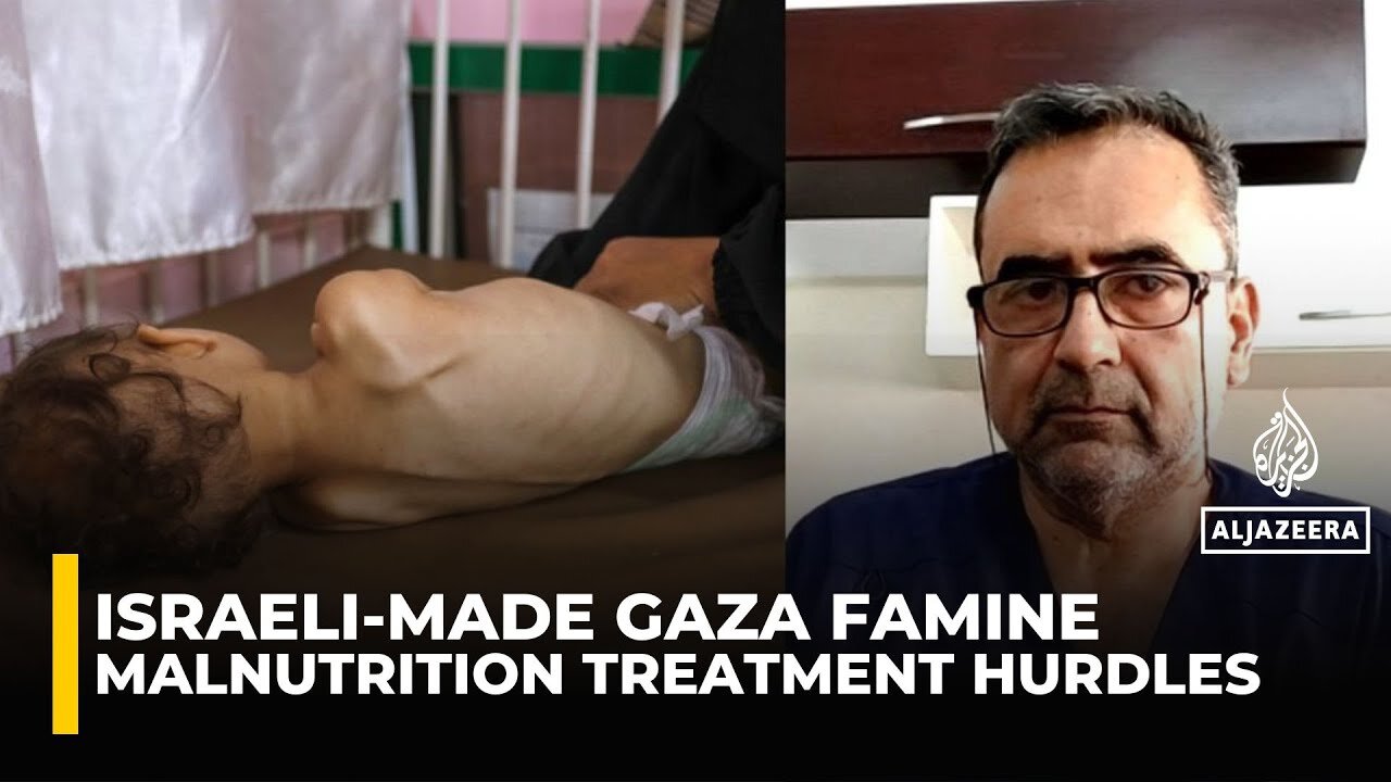 Doctor describes challenges of treating acute malnutrition patients in Gaza