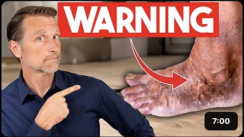 Your Feet Give You WARNING Signs of Underlying Diseases
