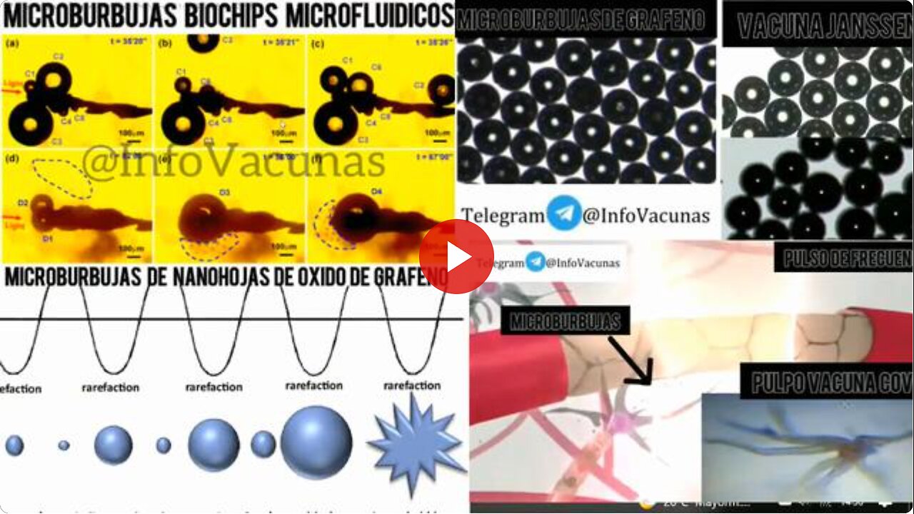 InfoVacunas - Graphene Microbubbles and EMFs Create COVID / Hemorrhagic Fever / Marburg Disease