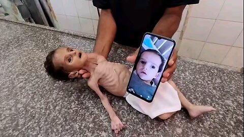 Child Jouri al-Masri Dies from Starvation Amid Ongoing Israeli Siege on Gaza