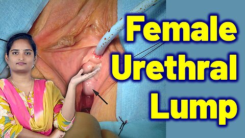 What a Urethral Caruncle Means | Urethral Lump, Urethral Swelling | Treatment Cure | Gynaecology