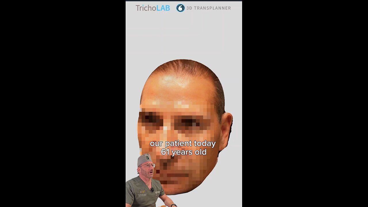 Hair Transplant Patient