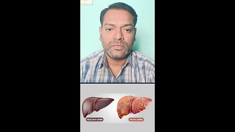 फैटी लीवर में लीवर खराब ।