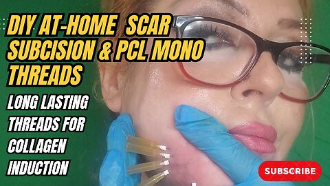 DIY ACNE SCAR SUBCISION & PCL MONO THREADS FOR COLLAGEN INDUCTION