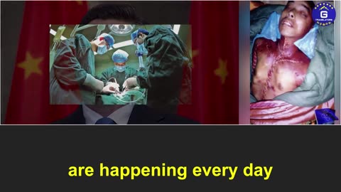 Live organ harvesting: the CCP's "killing on demand"