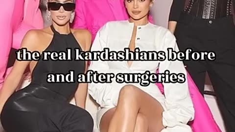 Shocking: kardashians before and after surgery #shorts #edit #kardashian #kylie