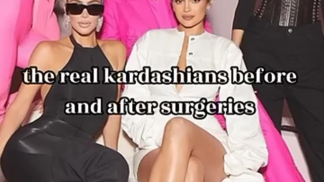 Shocking: kardashians before and after surgery #shorts #edit #kardashian #kylie