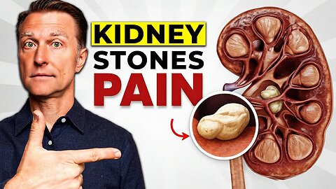 How to NEVER Get a Kidney Stone (20 Scientifically Proven Tips) 