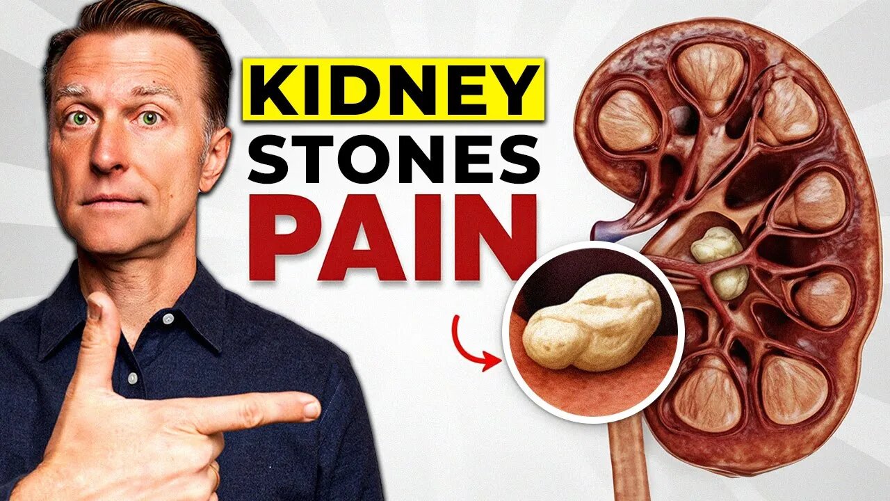How to NEVER Get a Kidney Stone (20 Scientifically Proven Tips)