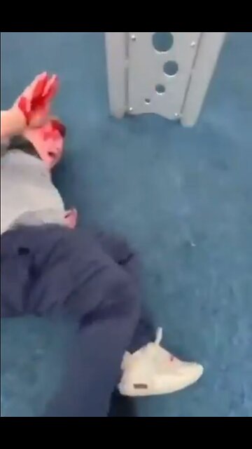 Bullies outnumber and torment child, leave him bloody. Fighting at playground