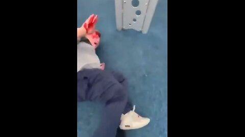 Bullies outnumber and torment child, leave him bloody. Fighting at playground