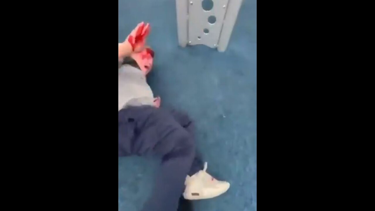 Bullies outnumber and torment child, leave him bloody. Fighting at playground