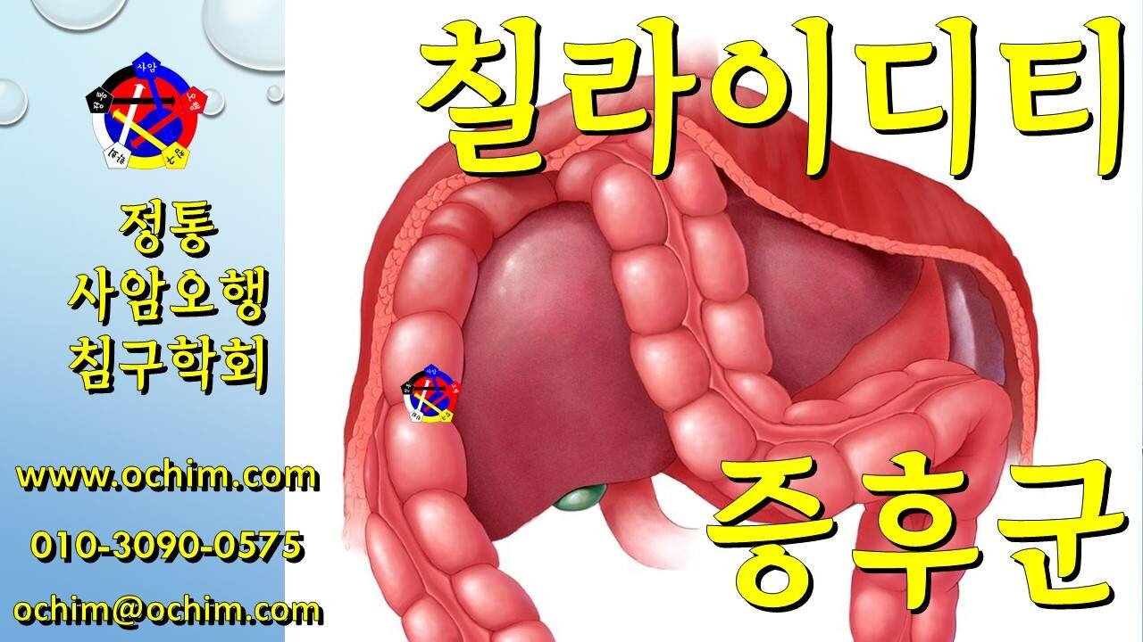 칠라이디티 증후군 치료 - 사암오행침, 사암침법, 오행침, 정통사암침
