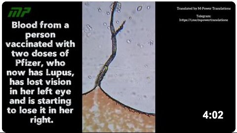 Blood from a person vaccinated with two doses of Pfizer, who now has Lupus, has lost vision in her left eye and is starting to lose it in her right.