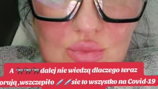 Bron Biologiczna Szczepionki.Preparat expp..