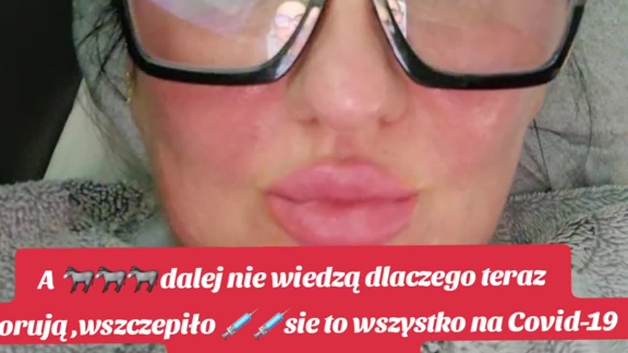 Bron Biologiczna Szczepionki.Preparat expp..