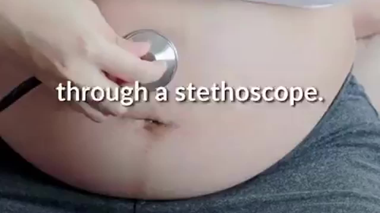 Unborn babies are human beings.