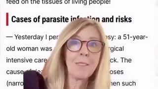 🚨 Autopsy shows 90% of the dead is full of Parasites