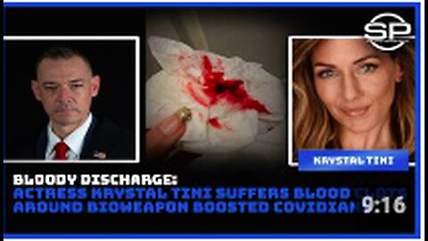 "Actress Krystal Tini Develops Blood Clots Post Bioweapon-Related COVID Treatment"