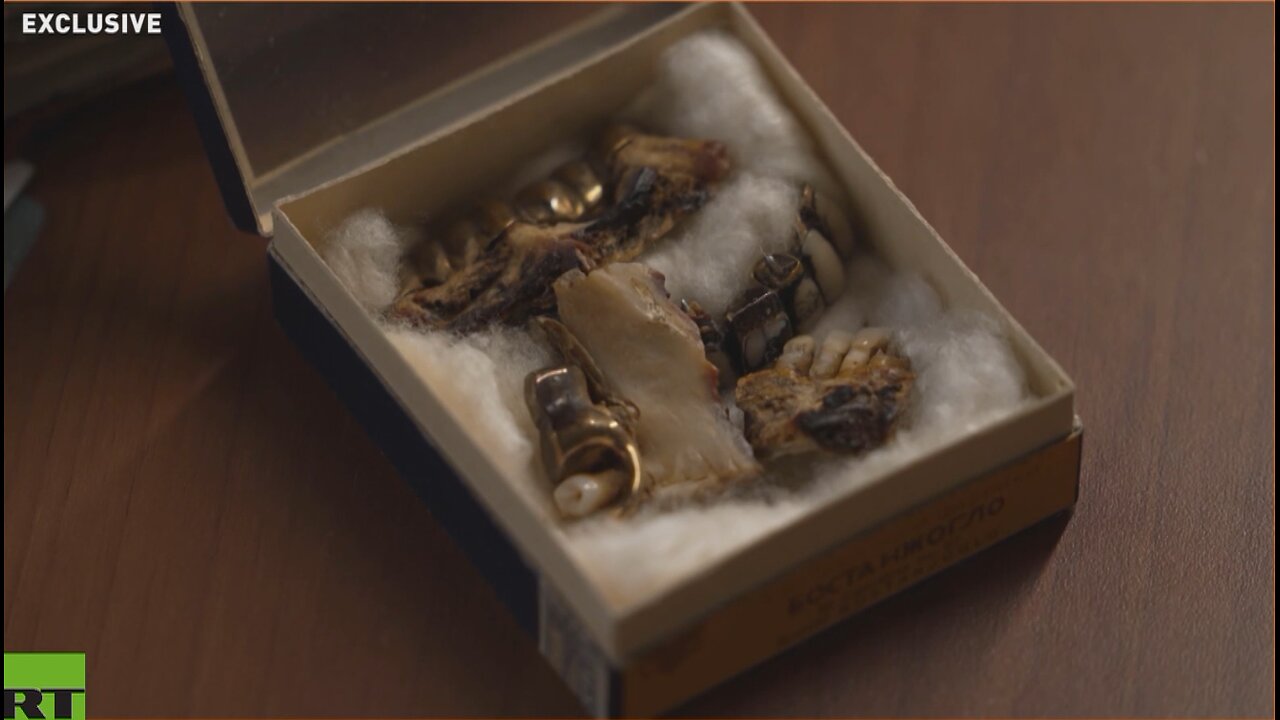 Hitler's teeth confirm he died in Berlin — Russian archives reveal