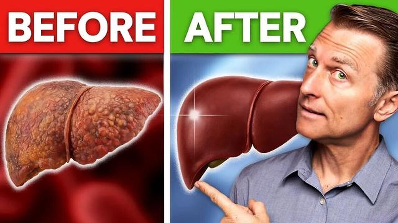 How to Detoxify a Fatty Liver by Dr Eric Berg