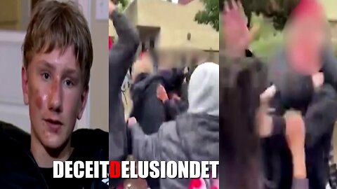 A 14-year-old white male student was attacked by a group of black students at Elk Grove school