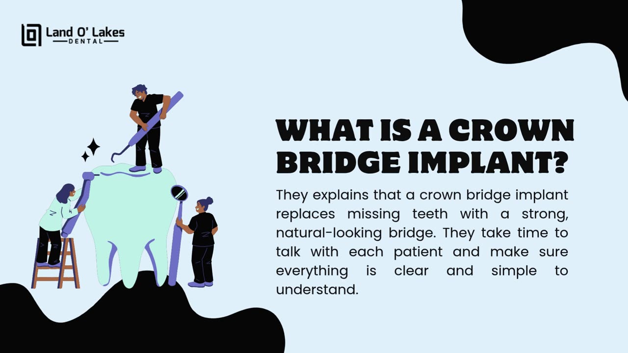 Land O’ Lakes Dental Explains Crown Bridge Implants
