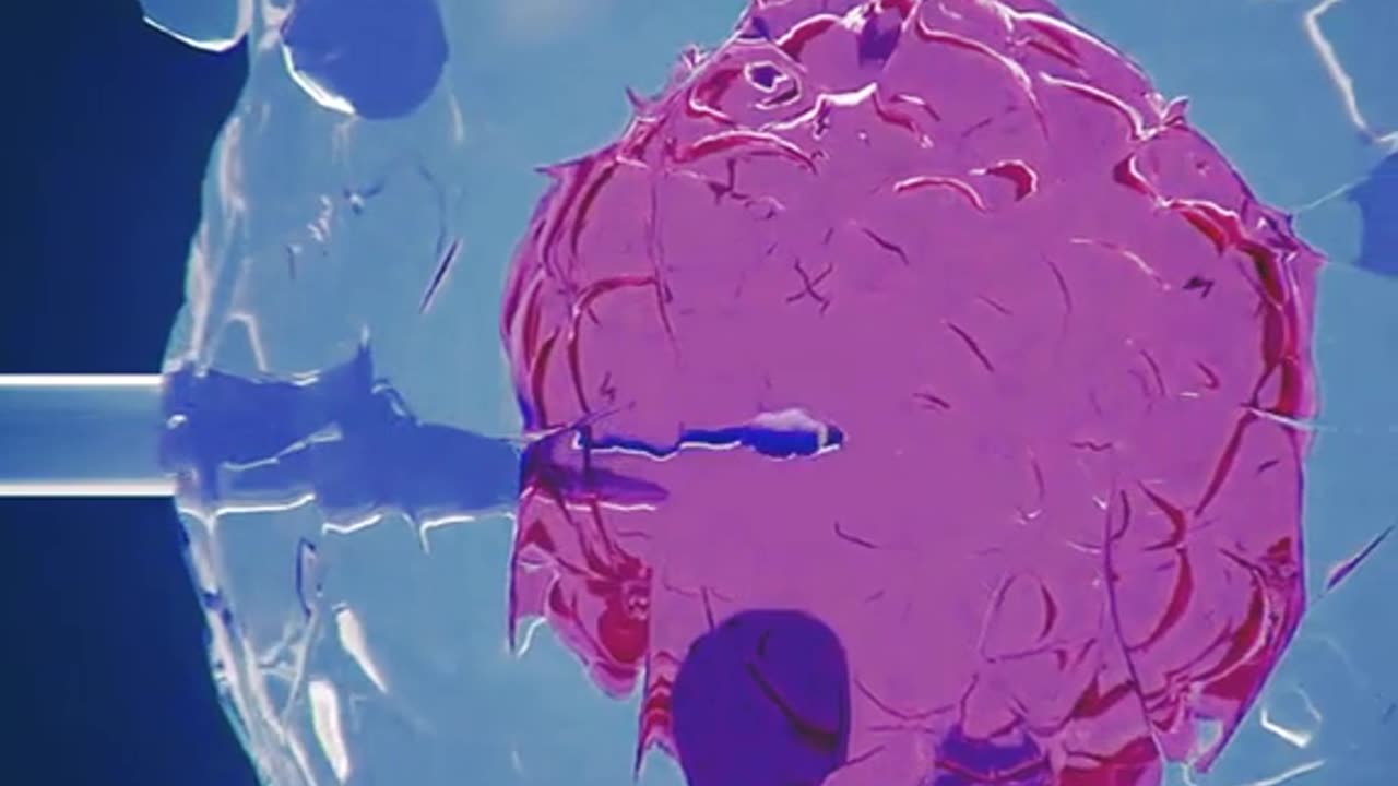 In Vitro Fertilization (IVF)