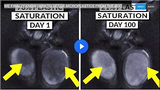 WE FINALLY KNOW HOW TO DETOX MICROPLASTICS FROM THE BODY