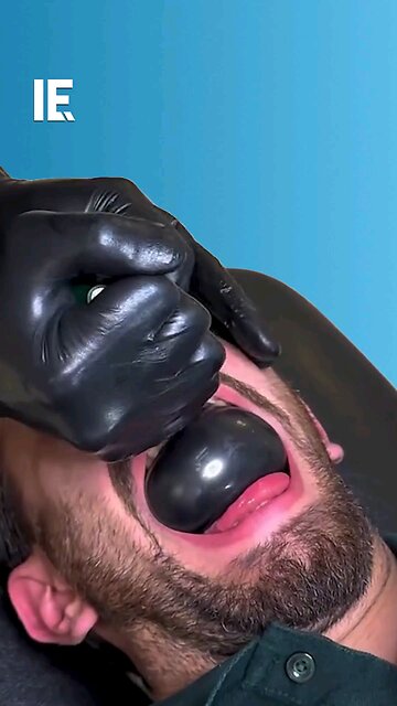 Would you ever consider trying balloon therapy as a medical treatment?