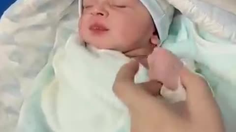 Shocking: #cutebaby birth with 6 fingers #viral #babyshorts #newborn #babygirl