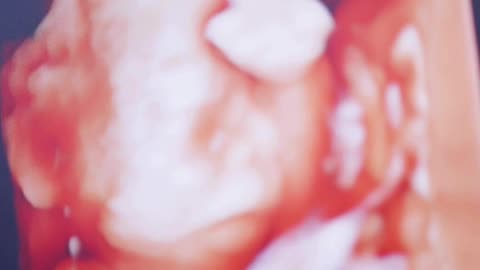 Understanding Test Tube Baby Treatment: A Path to Parenthood
