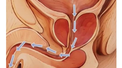 Expert Urology Care at Sumathi Hospital, Madurai