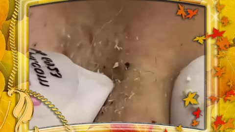 *Skin with small black eyes.*