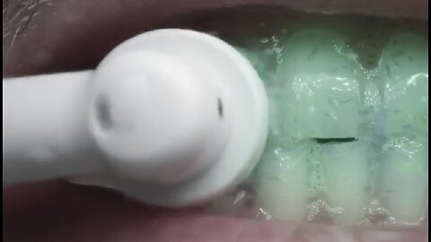 Mix Your Own “Dental Elixir” At Home And Rebuild Your Teeth Twice As Fast