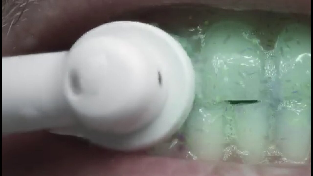 Mix Your Own “Dental Elixir” At Home And Rebuild Your Teeth Twice As Fast