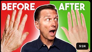 The Best Fix for Dry and Wrinkled Skin