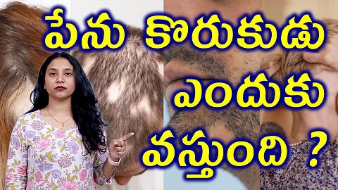 పేను కొరుకుడు ఎందుకు వస్తుంది?Causes for Alopecia Areata or Spot Baldness Homeopathy Treatment Cure