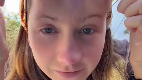 Bulbous Tissue Expanders Help Scars Heal