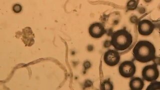 Baking soda versus parasites