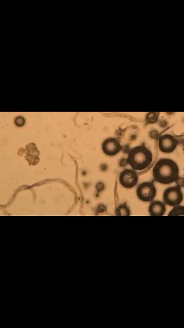 Baking soda versus parasites