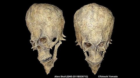 The Starchild Skull, The Conspiracy Show with Richard Syrett, Ep218