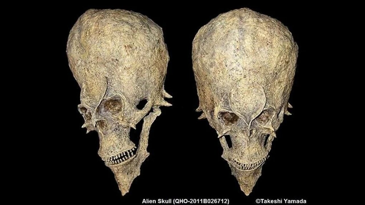 The Starchild Skull, The Conspiracy Show with Richard Syrett, Ep218