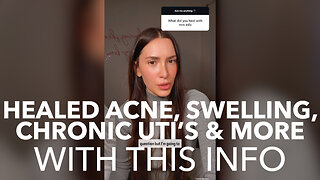 Healed Acne, Swelling, Chronic UTI's & More With This Info