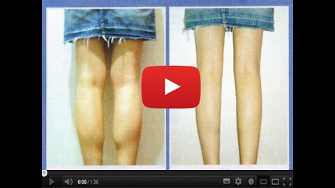 7-Second “Water Dumping” Fix Gets You Rid of Swollen Legs & Ankles