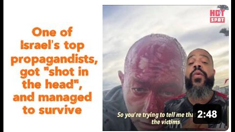 One of Israel’s top propagandists, got “shot in the head”, and managed to survive.