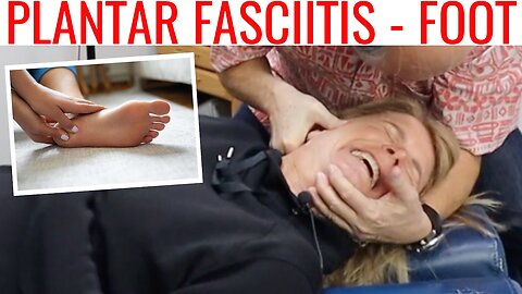 Plantar Fasciitis (foot pain) & Tennis game suffers treated by Chiropractor 1/2